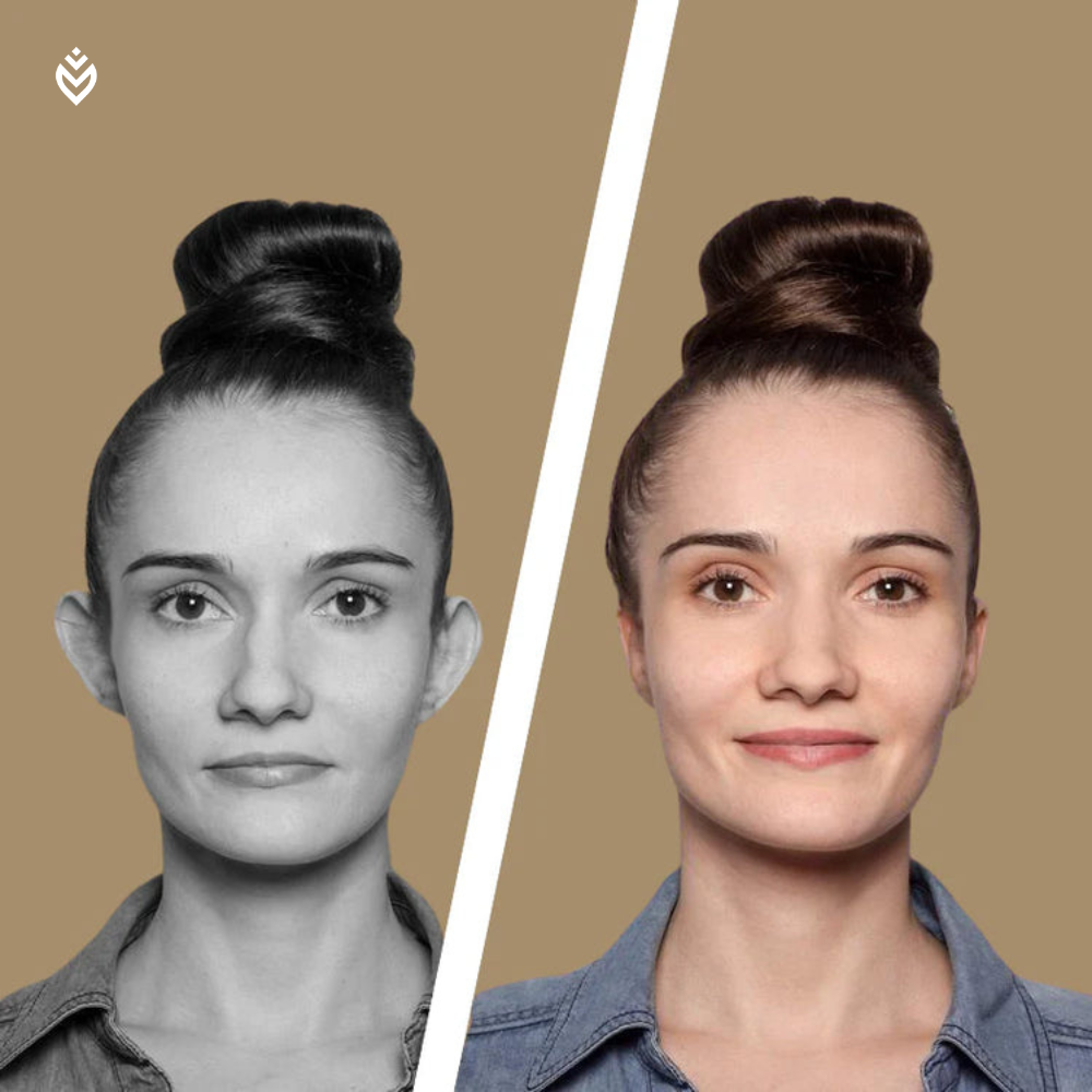Moov™ Ears Corrector