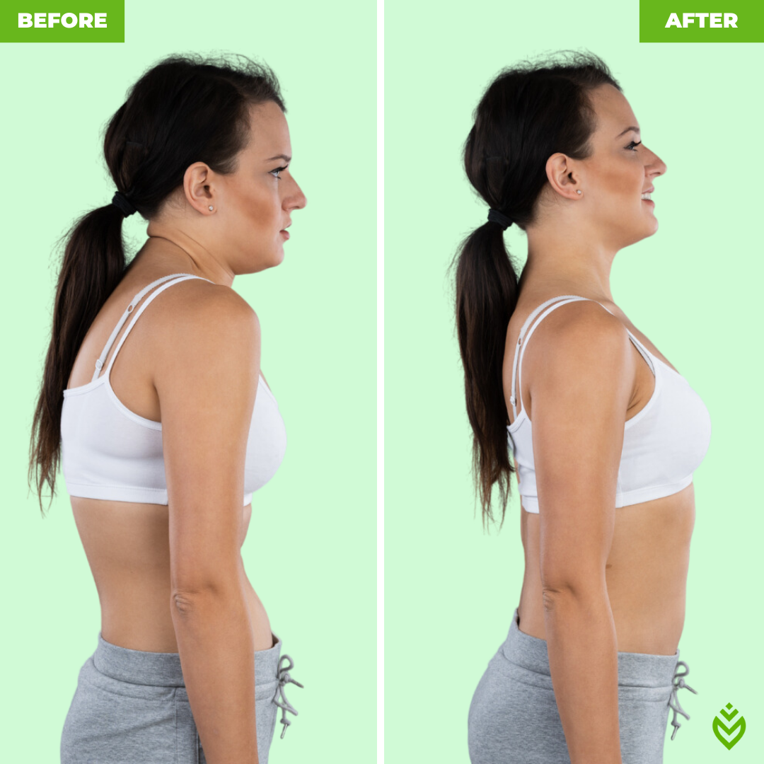 Moov™ Posture Corrector