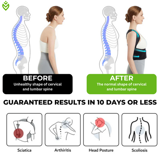Moov™ Posture Corrector